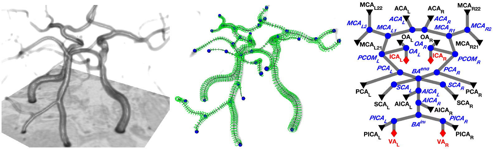 Circle of Willis - MR angiography, geodesic segmentation, vascular graph and lumped-parameter network